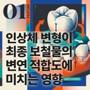 ai thumbnail poster 인상체 변형이 최종 보철물의 변연 적합도에 미치는 영향 1787148508